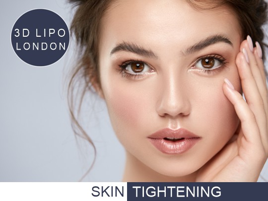 Skin tightening