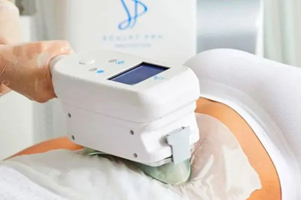 Cryolipolysis treatment session